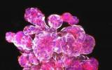 靶向放射治疗，Nature Cancer发现免疫疗法对最难治疗的乳腺癌无效的原因